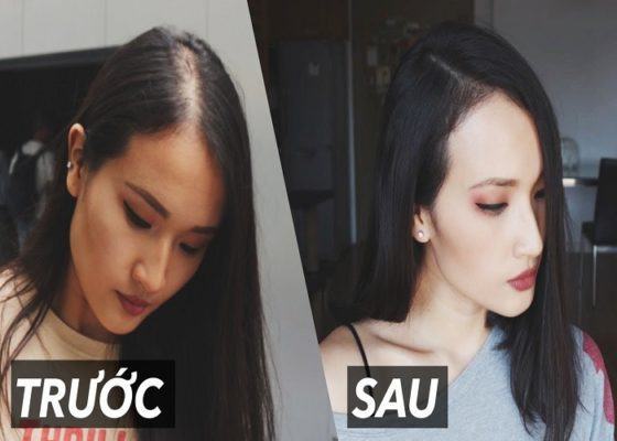 Cách kích thích mọc tóc cực nhanh