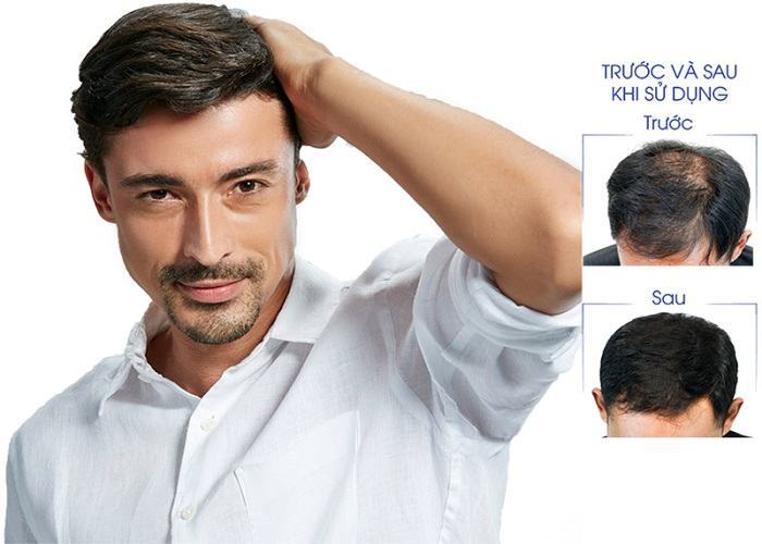4 cách làm thẳng tóc xoăn nam cực hiệu quả và tốn ít chi phí