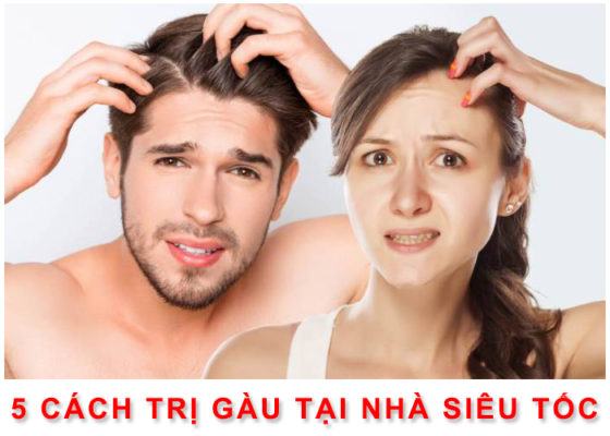 Cách trị gàu dứt điểm tại nhà