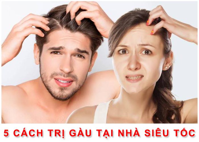 Cách trị gàu dứt điểm tại nhà